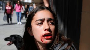 Attack in Spain: 'A dog ripped my mouth open and it’s ruining my life'